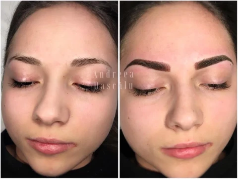 Micropigmentare, tatuaj sprancene, Microblading, Scos tatuaje